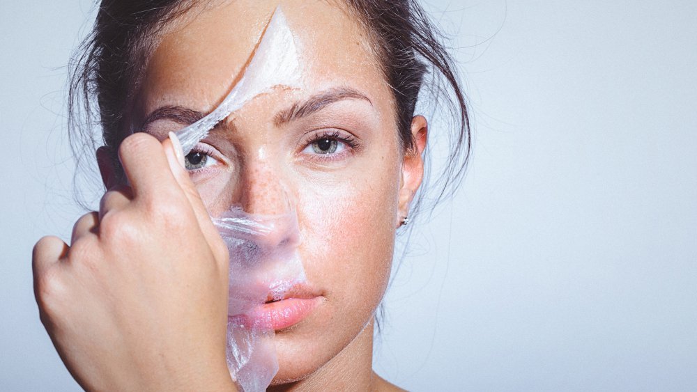 melasma